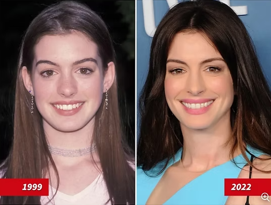Anne Hathaway1